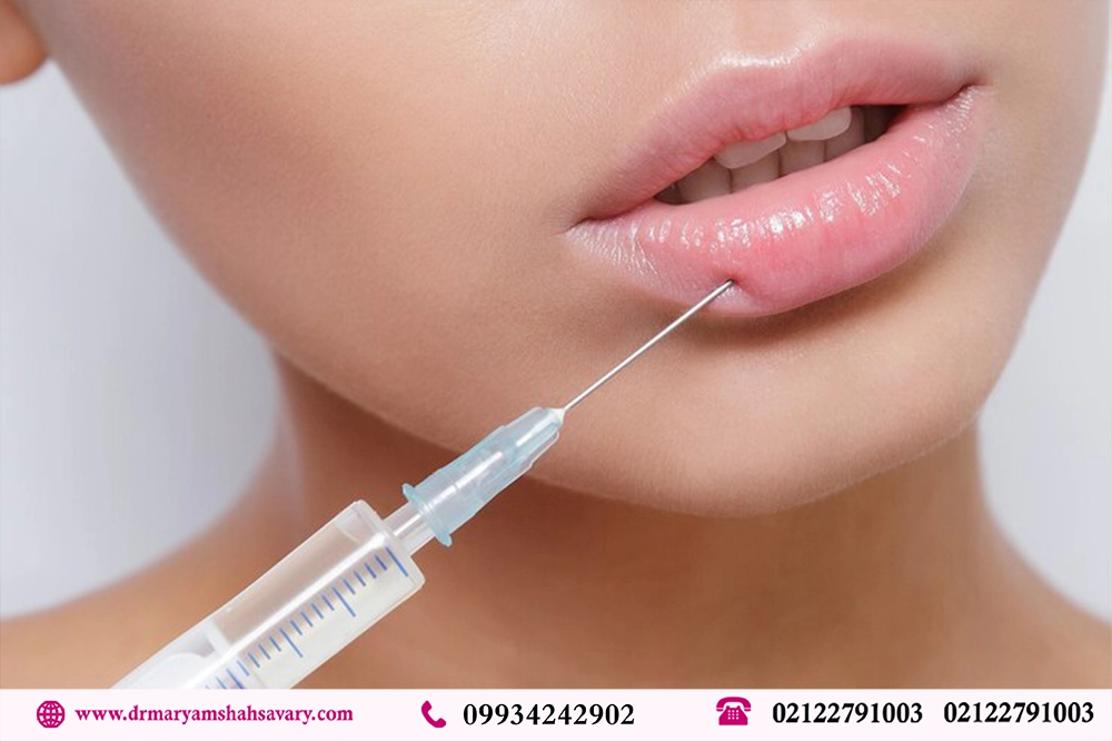 بهترین دکتر تزریق ژل لب در کامرانیه تهران