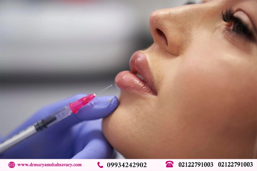 تزریق ژل لب در کامرانیه تهران