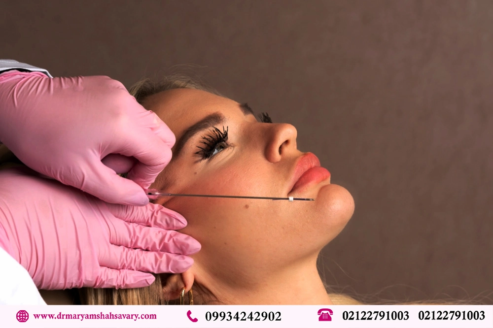 عکس واقعی لیفت صورت با نخ