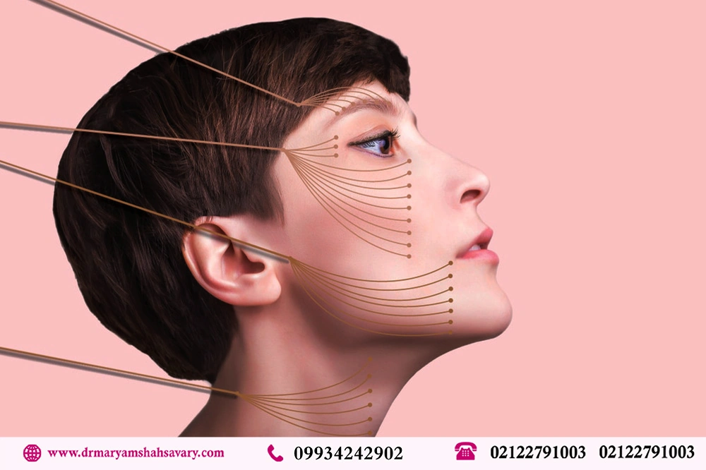 بهترین کلینیک لیفت صورت با نخ در اقدسیه تهران