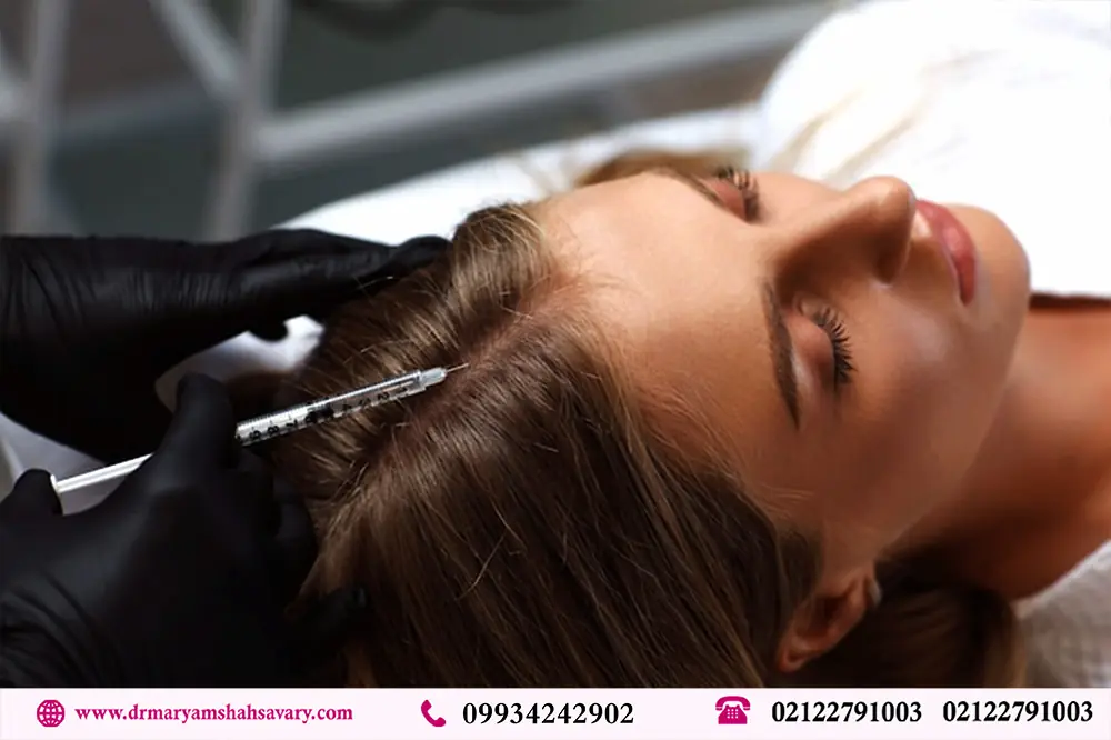 مزوتراپی مو در تهران